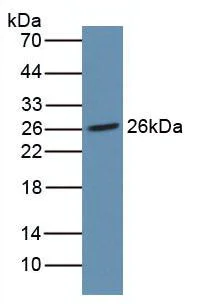 Western blot - Anti-Noggin antibody [A11] (AB239520)