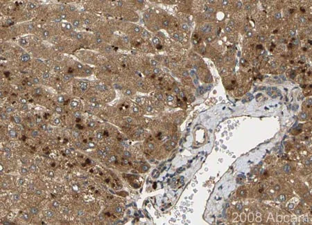 Immunohistochemistry (Formalin/PFA-fixed paraffin-embedded sections) - Anti-Noggin antibody (AB16054)