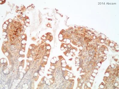 Immunohistochemistry (Formalin/PFA-fixed paraffin-embedded sections) - Anti-Noggin antibody (AB16054)
