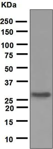 Western blot - Anti-Noggin antibody [EPR1561] (AB124977)