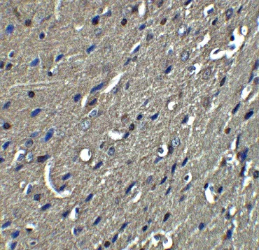 Immunohistochemistry (Formalin/PFA-fixed paraffin-embedded sections) - Anti-Nogo A antibody (AB62024)