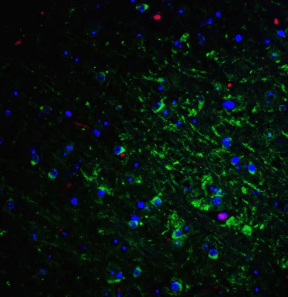 Immunohistochemistry (Formalin/PFA-fixed paraffin-embedded sections) - Anti-Nogo A antibody (AB62024)