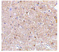 Immunohistochemistry (Formalin/PFA-fixed paraffin-embedded sections) - Anti-Nogo A antibody (AB62024)