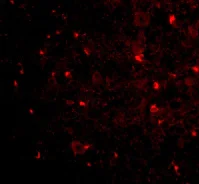 Immunohistochemistry (Formalin/PFA-fixed paraffin-embedded sections) - Anti-Nogo A antibody (AB62024)