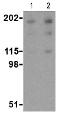 Western blot - Anti-Nogo A antibody (AB62024)