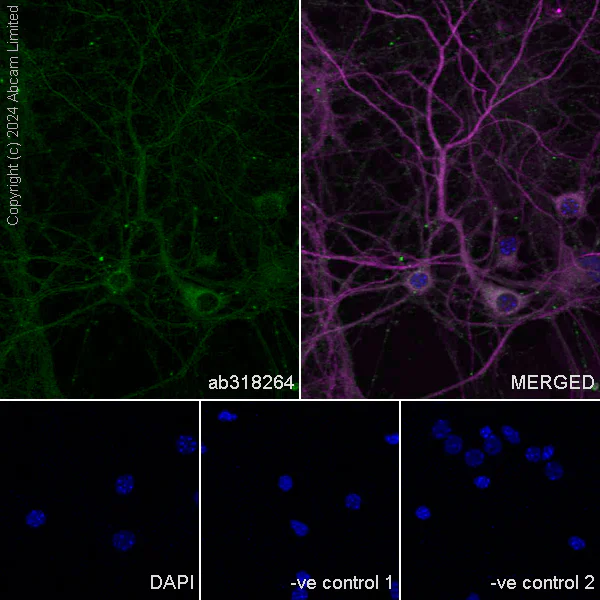 Immunocytochemistry/ Immunofluorescence - Anti-Nogo A + Nogo D antibody [EPR26286-15] - BSA and Azide free (AB318265)