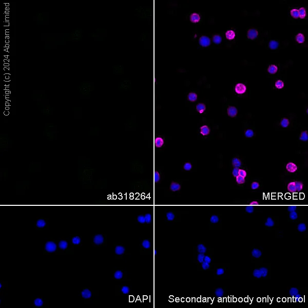 Immunocytochemistry/ Immunofluorescence - Anti-Nogo A + Nogo D antibody [EPR26286-15] - BSA and Azide free (AB318265)