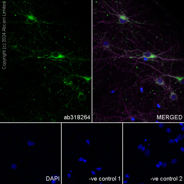 Immunocytochemistry/ Immunofluorescence - Anti-Nogo A + Nogo D antibody [EPR26286-15] - BSA and Azide free (AB318265)