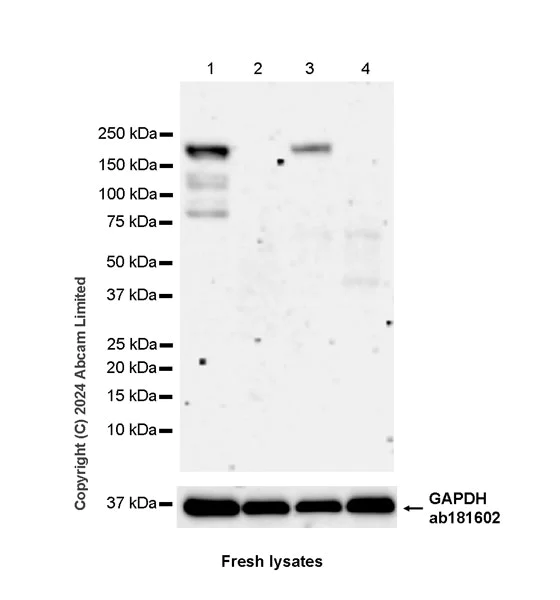 Western blot - Anti-Nogo A + Nogo D antibody [EPR26286-15] - BSA and Azide free (AB318265)
