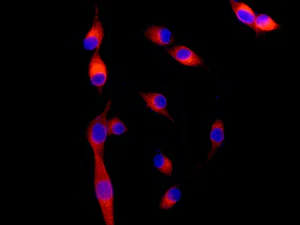 Immunocytochemistry/ Immunofluorescence - Anti-Nogo antibody [EPR12265] (AB180847)