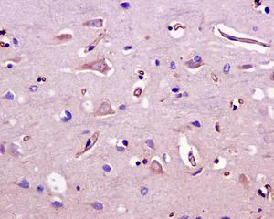 Immunohistochemistry (Formalin/PFA-fixed paraffin-embedded sections) - Anti-Nogo antibody [EPR12265] (AB180847)