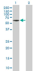 Western blot - Anti-Nogo Receptor antibody (AB172653)