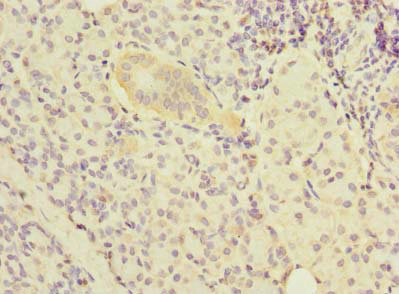 Immunohistochemistry (Formalin/PFA-fixed paraffin-embedded sections) - Anti-NOL10 antibody (AB235529)