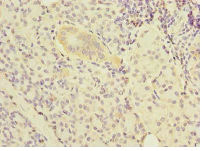 Immunohistochemistry (Formalin/PFA-fixed paraffin-embedded sections) - Anti-NOL10 antibody (AB235529)