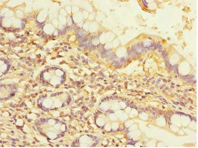 Immunohistochemistry (Formalin/PFA-fixed paraffin-embedded sections) - Anti-NOL10 antibody (AB235529)