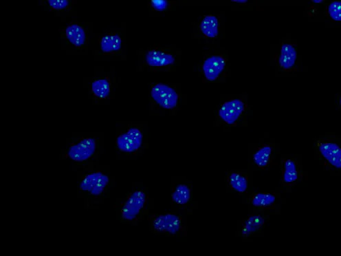 Immunocytochemistry/ Immunofluorescence - Anti-NOL10 antibody [EPR14073-8] - BSA and Azide free (AB250387)