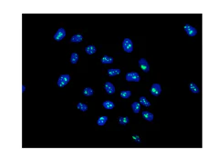 Immunocytochemistry/ Immunofluorescence - Anti-NOL10 antibody [EPR14073-9] - BSA and Azide free (AB250388)