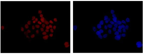 Immunocytochemistry/ Immunofluorescence - Anti-NOL11 antibody [EPR14074-30] (AB181996)