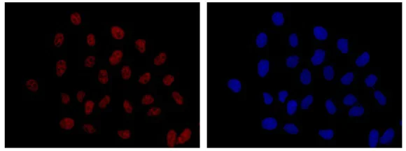 Immunocytochemistry/ Immunofluorescence - Anti-NOL11 antibody [EPR14074-30] (AB181996)