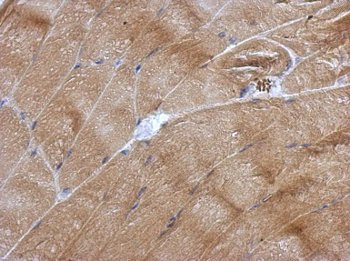 Immunohistochemistry (Formalin/PFA-fixed paraffin-embedded sections) - Anti-NOL3 antibody (AB126238), expandable thumbnail