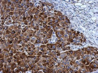 Immunohistochemistry (Formalin/PFA-fixed paraffin-embedded sections) - Anti-NOL3 antibody (AB126238), expandable thumbnail