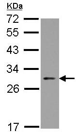 Western blot - Anti-NOL3 antibody (AB126238), expandable thumbnail