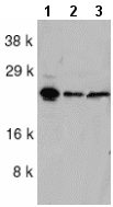 Western blot - Anti-NOL3 antibody (AB2002), expandable thumbnail