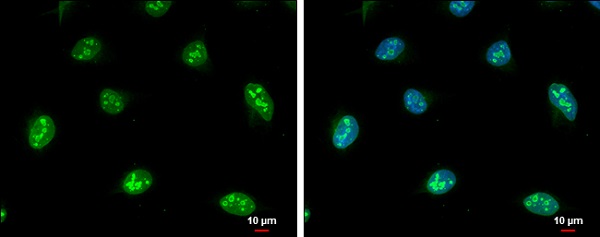 Immunocytochemistry/ Immunofluorescence - Anti-NOL5A antibody - C-terminal (AB229497)