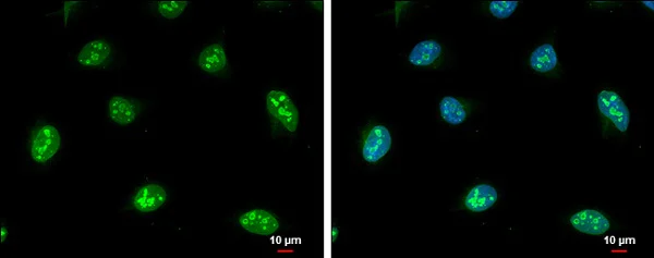 Immunocytochemistry/ Immunofluorescence - Anti-NOL5A antibody - C-terminal (AB229497)