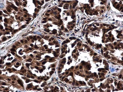 Immunohistochemistry (Formalin/PFA-fixed paraffin-embedded sections) - Anti-NOL5A antibody - C-terminal (AB229497)