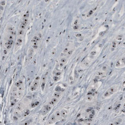 Immunohistochemistry (Formalin/PFA-fixed paraffin-embedded sections) - Anti-NOL5A antibody [CL2603] (AB242201)