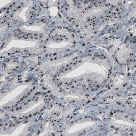 Immunohistochemistry (Formalin/PFA-fixed paraffin-embedded sections) - Anti-NOL5A antibody [CL2603] (AB242201)