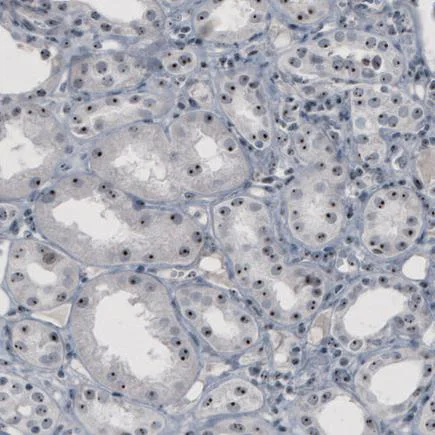 Immunohistochemistry (Formalin/PFA-fixed paraffin-embedded sections) - Anti-NOL5A antibody [CL2603] (AB242201)