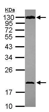 Western blot - Anti-NOL6 antibody (AB228836)
