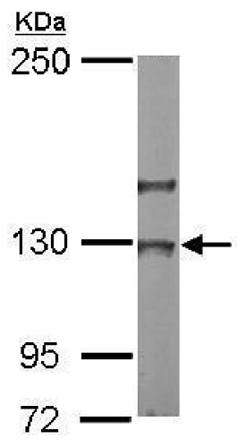 Western blot - Anti-NOL6 antibody (AB228836), expandable thumbnail