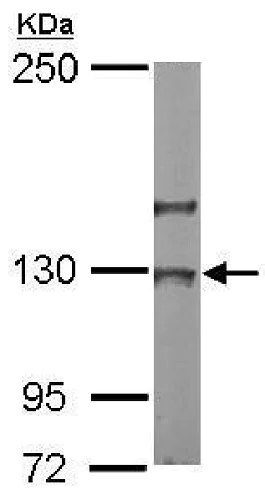 Western blot - Anti-NOL6 antibody (AB228836)