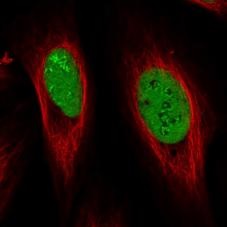 Immunocytochemistry - Anti-NOLA1 antibody (AB188617), expandable thumbnail