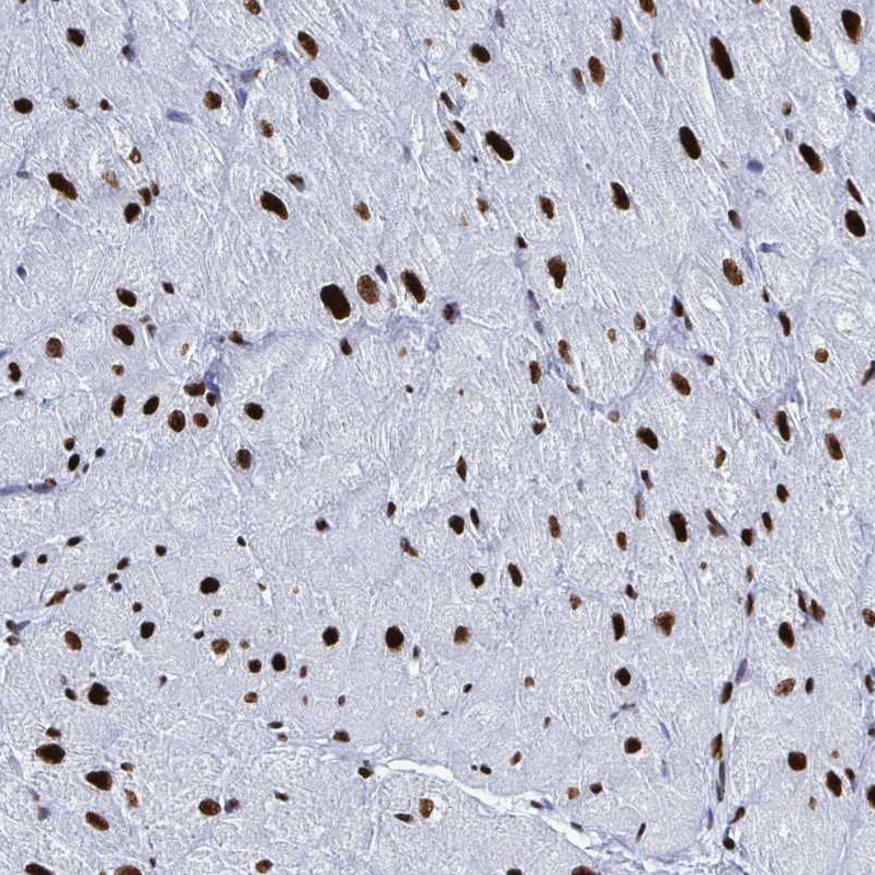 Immunohistochemistry (Formalin/PFA-fixed paraffin-embedded sections) - Anti-NOLA1 antibody (AB188617), expandable thumbnail