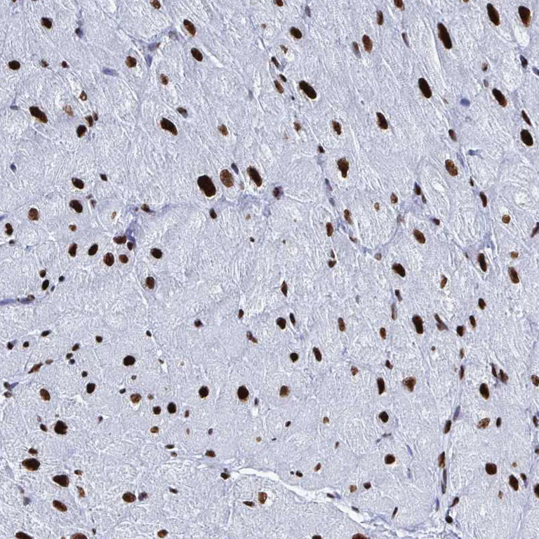 Immunohistochemistry (Formalin/PFA-fixed paraffin-embedded sections) - Anti-NOLA1 antibody (AB188617)