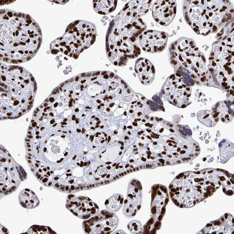 Immunohistochemistry (Formalin/PFA-fixed paraffin-embedded sections) - Anti-NOLA1 antibody (AB188617)