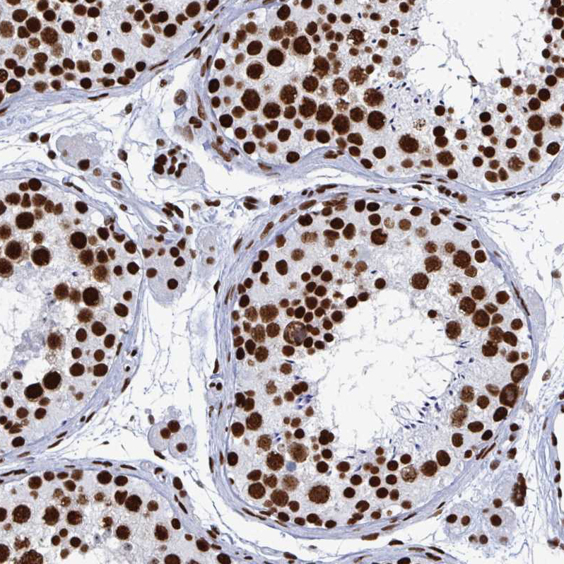 Immunohistochemistry (Formalin/PFA-fixed paraffin-embedded sections) - Anti-NOLA1 antibody (AB188617), expandable thumbnail