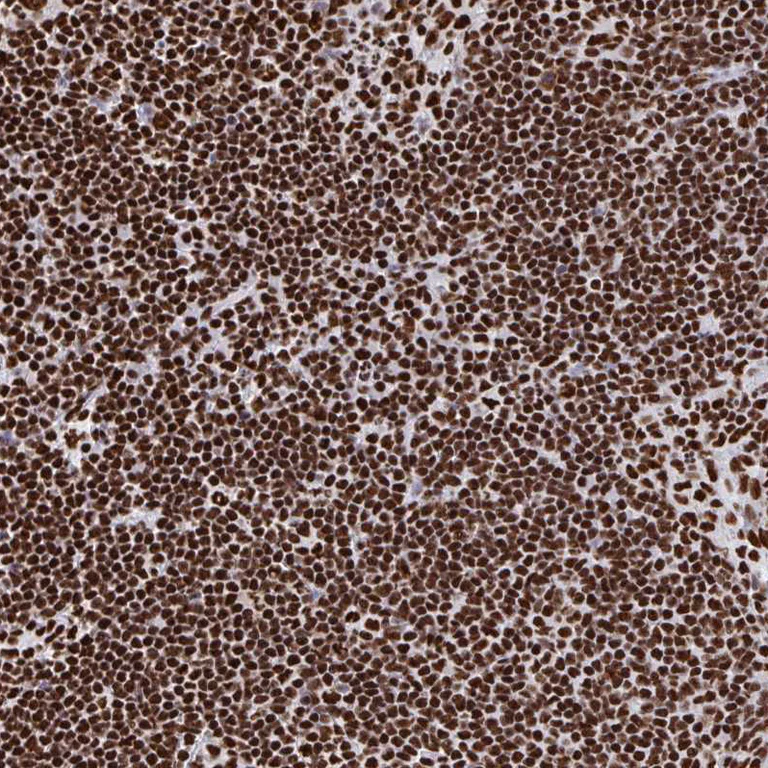 Immunohistochemistry (Formalin/PFA-fixed paraffin-embedded sections) - Anti-NOLA1 antibody (AB188617)