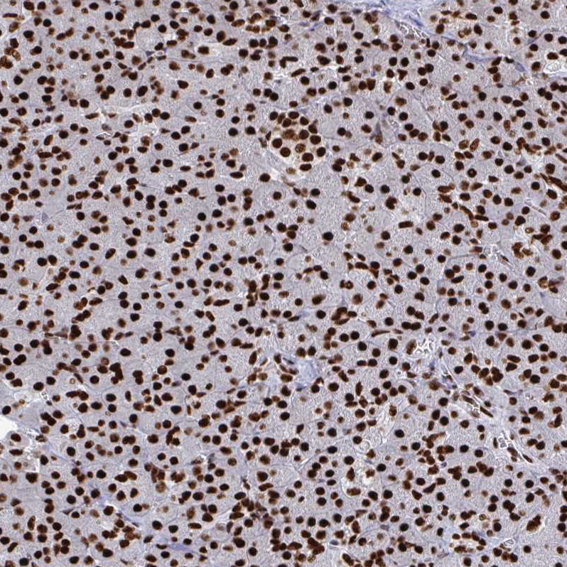 Immunohistochemistry (Formalin/PFA-fixed paraffin-embedded sections) - Anti-NOLA1 antibody (AB188617), expandable thumbnail