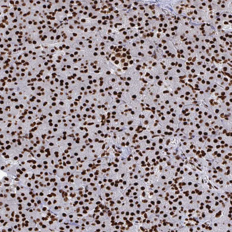 Immunohistochemistry (Formalin/PFA-fixed paraffin-embedded sections) - Anti-NOLA1 antibody (AB188617)