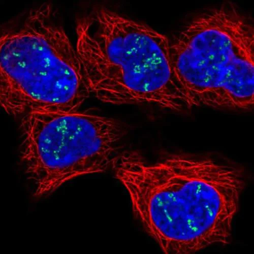 Immunocytochemistry/ Immunofluorescence - Anti-NOLC1 antibody (AB204318)