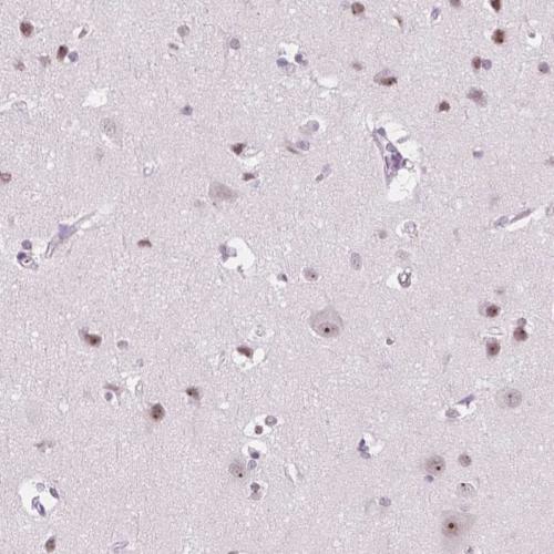 Immunohistochemistry (Formalin/PFA-fixed paraffin-embedded sections) - Anti-NOLC1 antibody (AB204318)