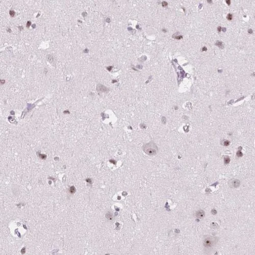 Immunohistochemistry (Formalin/PFA-fixed paraffin-embedded sections) - Anti-NOLC1 antibody (AB204318)