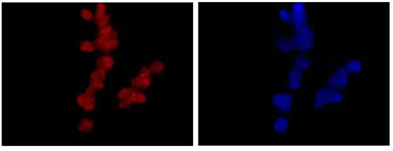 Immunocytochemistry/ Immunofluorescence - Anti-NOLC1 antibody [EPR14896] - BSA and Azide free (AB246325)
