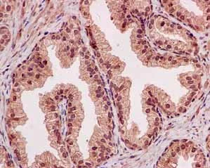 Immunohistochemistry (Formalin/PFA-fixed paraffin-embedded sections) - Anti-NOLC1 antibody [EPR14896] - BSA and Azide free (AB246325)