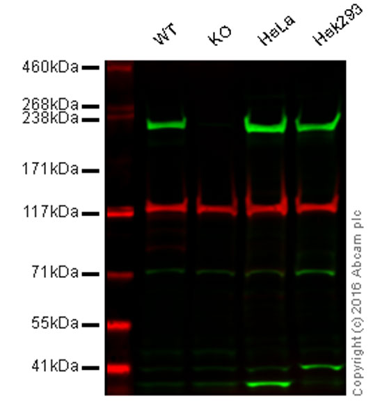 Western blot - Anti-non-muscle Myosin IIA antibody (AB75590)